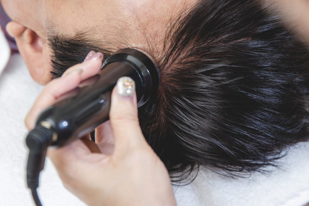 頭髮生長治療週期植髮雄性禿價格