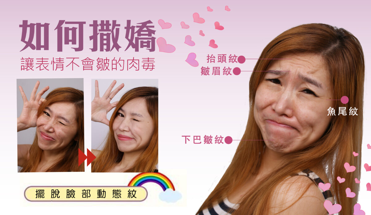 如何撒嬌肉毒除皺動態表情紋