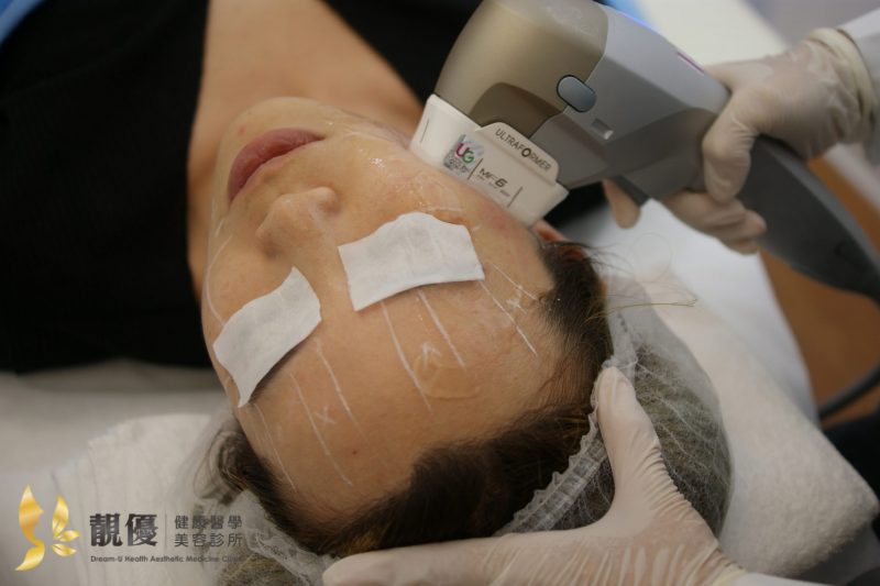 音波拉提施打中