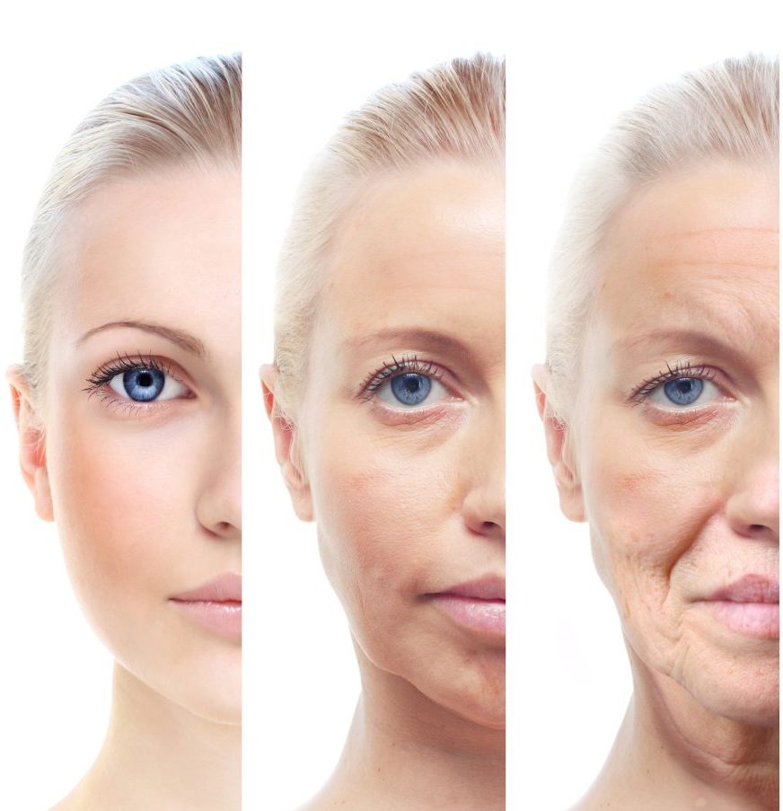 皮膚的漸進式鬆弛皺紋老化現象