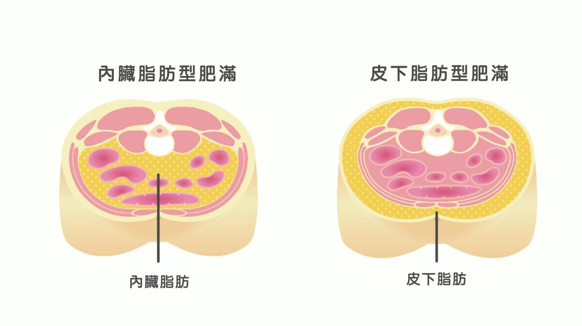 Saxenda減肥針 速纖筆
