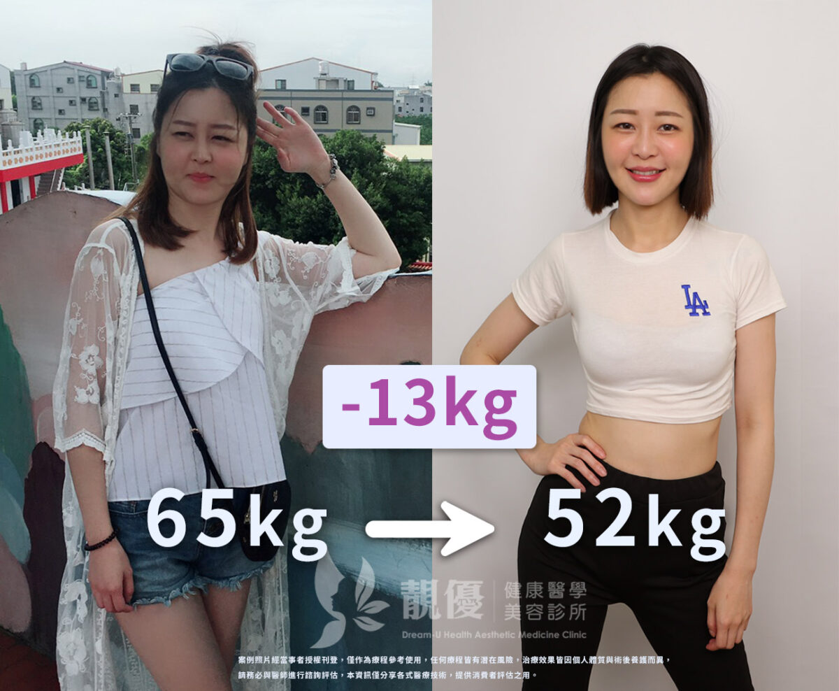 Saxenda減肥針瘦瘦筆案例分享