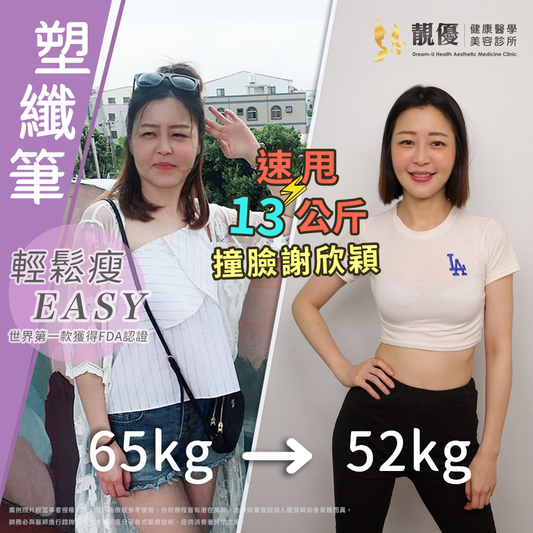 善纖達,靚優,鄭嘉琪,醫美診所,靚優醫美,減重筆,台北推薦