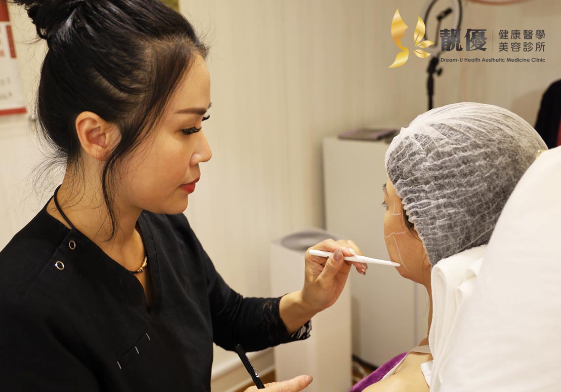 埋線拉提,靚優,鄭嘉琪,醫美診所,靚優醫美,藍鑽魚骨線,台北推薦