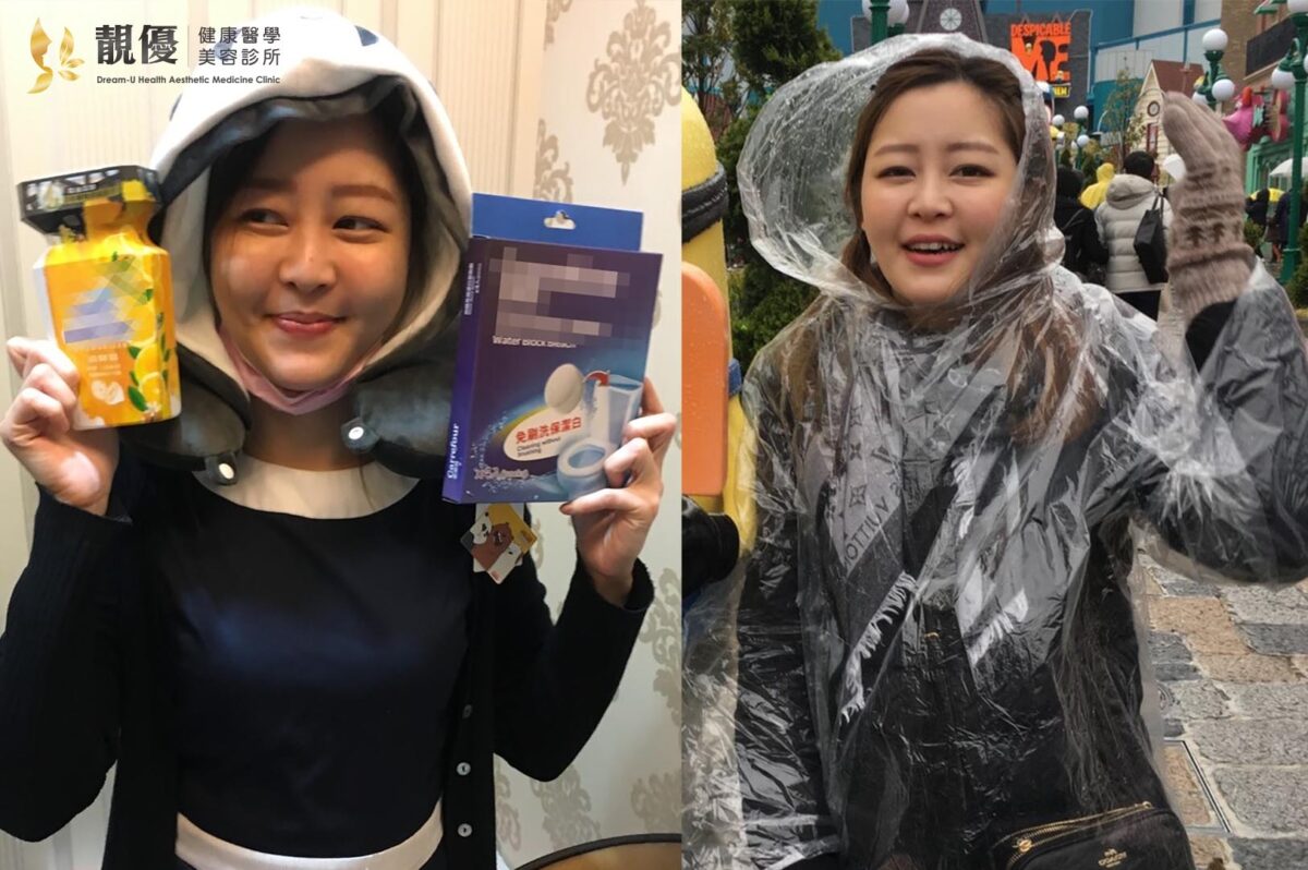 善纖達,靚優,鄭嘉琪,醫美診所,靚優醫美,減重筆,台北推薦,塑纖筆