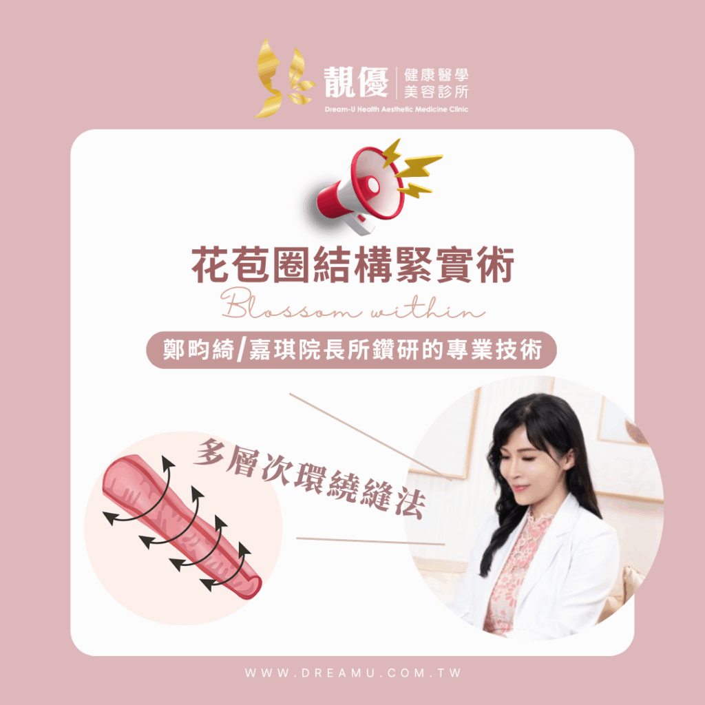 花苞圈微創陰道緊實療程說明圖