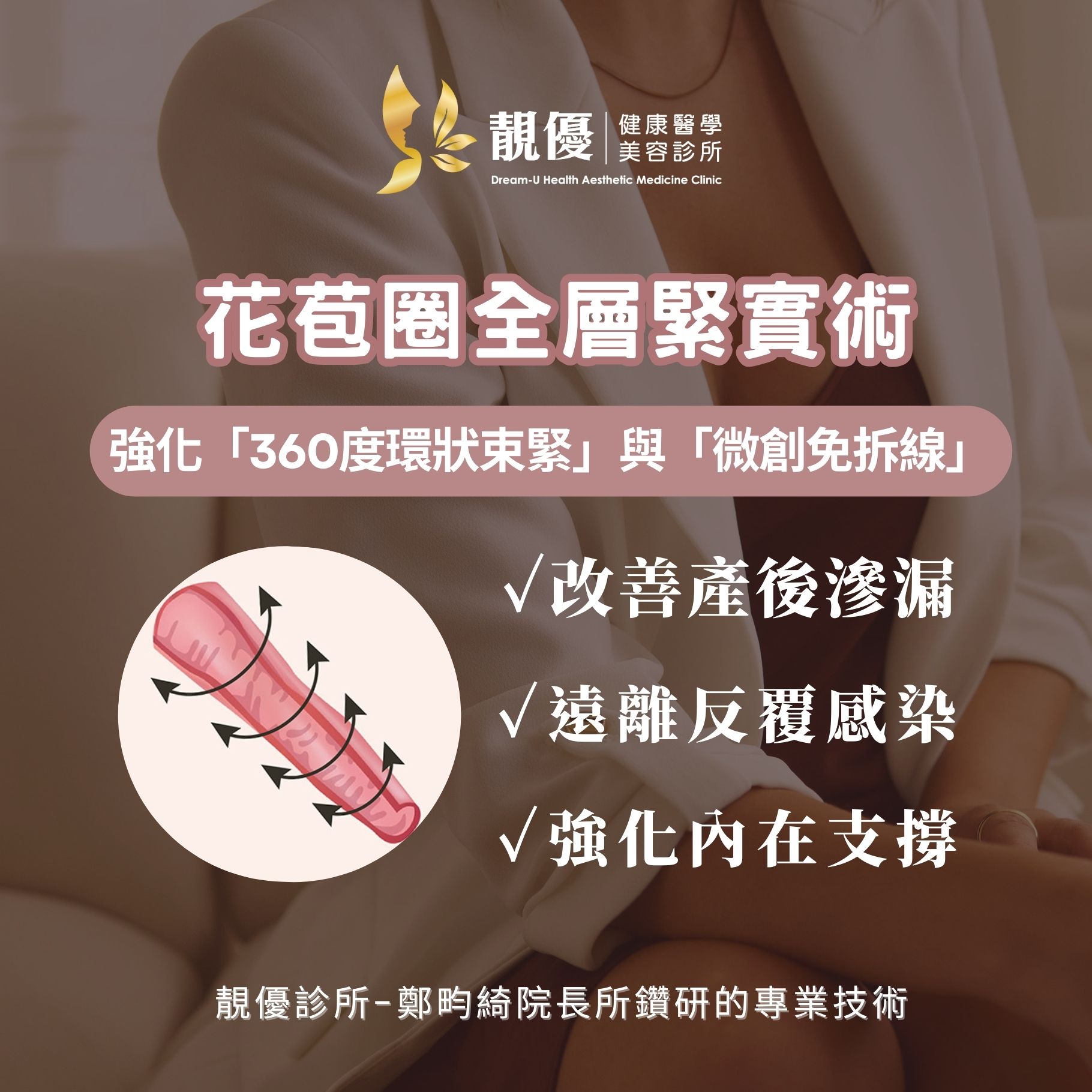 韓式4D花苞圈緊實術與傳統手術專業對照示意圖