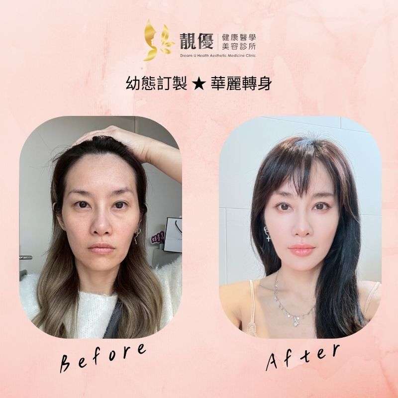 洢蓮絲成果