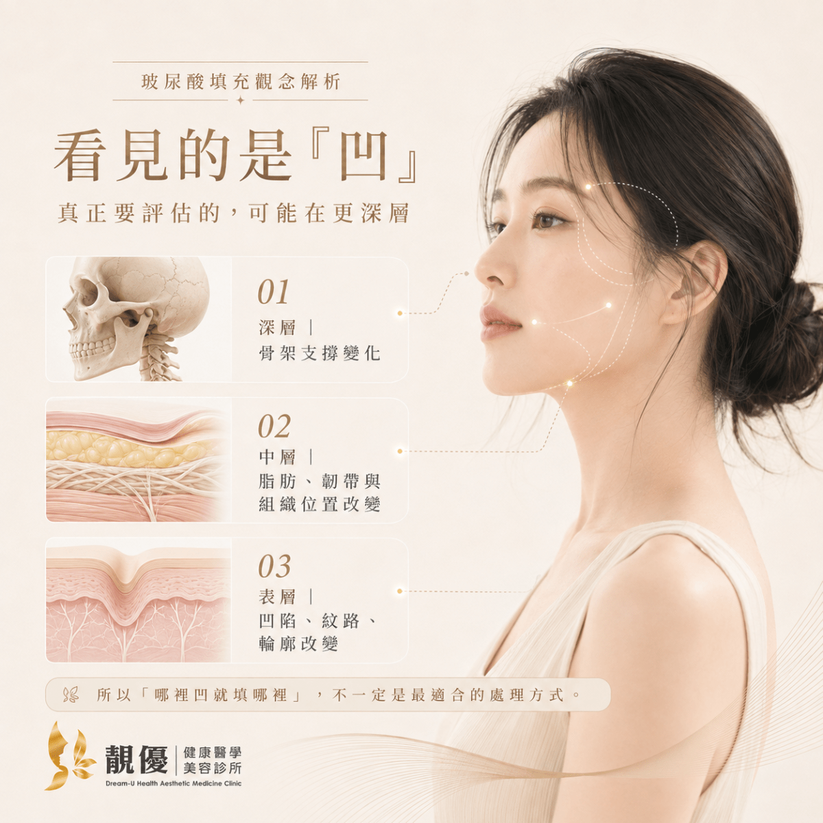 填充前何時該重新評估?最佳時機解析