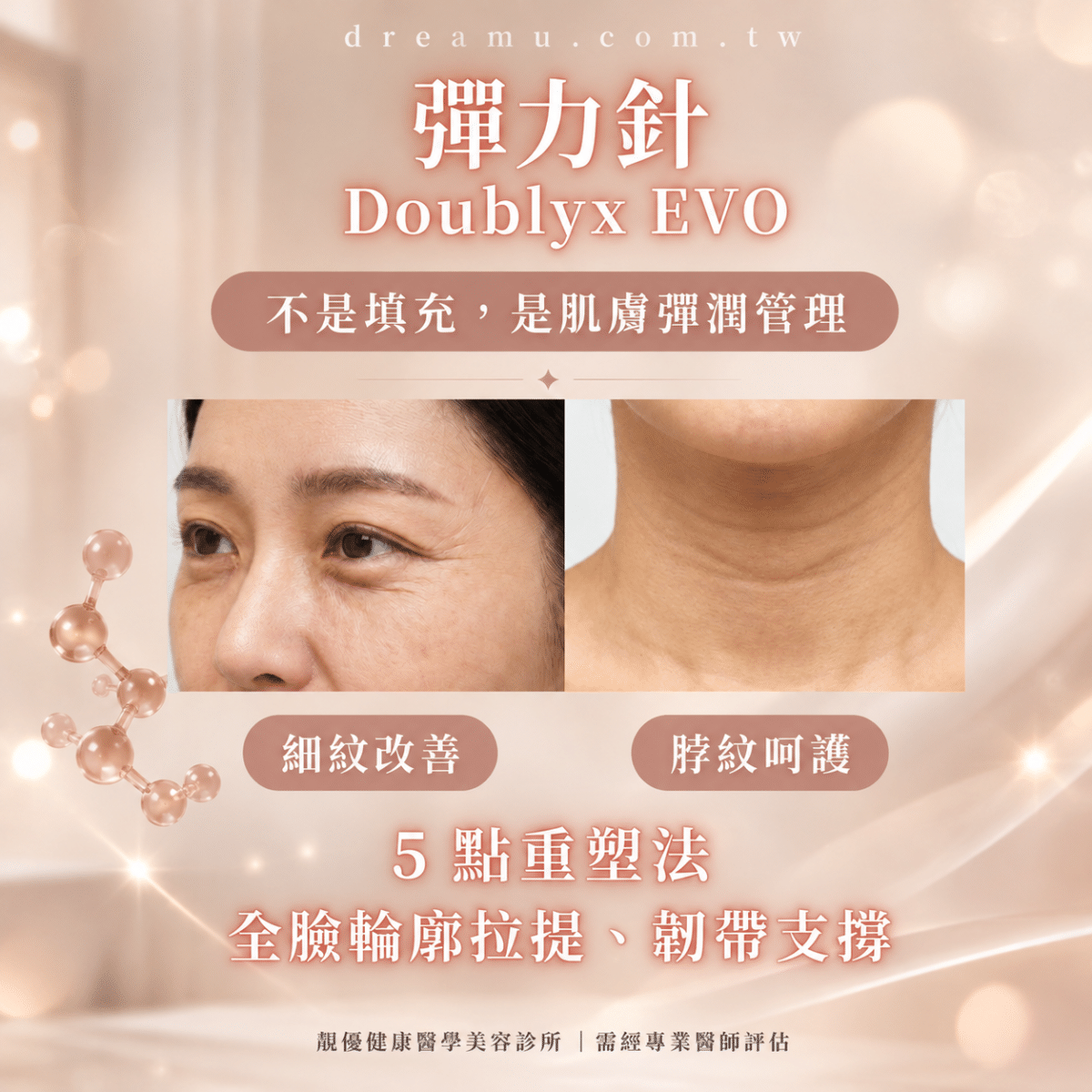 Doublyx EVO 彈力針細紋改善與脖紋呵護5點重塑法